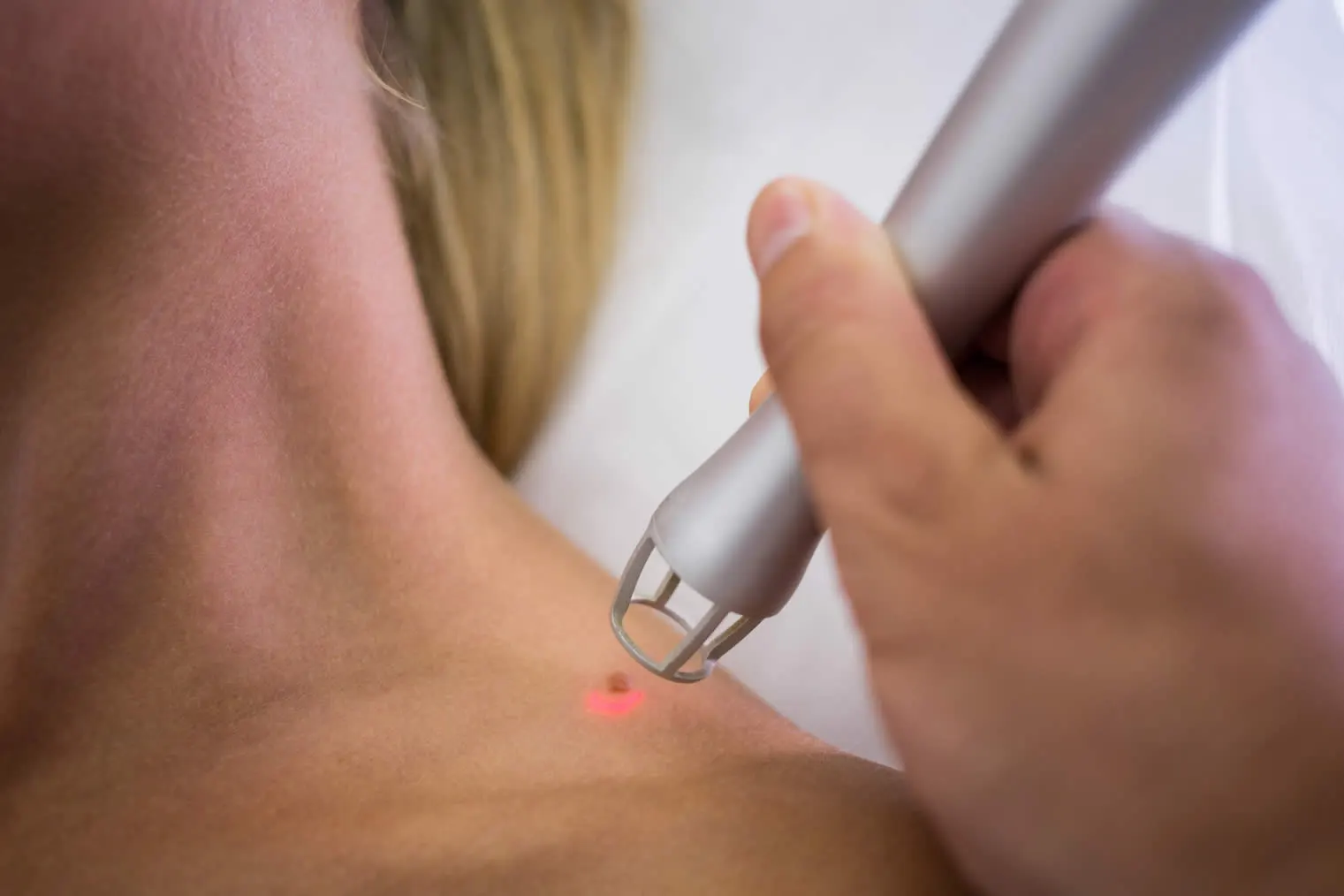medical dermatology woman dermatologist-removing-mole-from-womans-shoulder (1)
